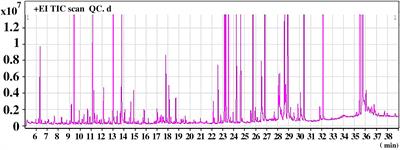 Metabolomic Profiling Revealed Potential Biomarkers in Patients With Moyamoya Disease